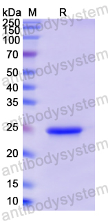 Recombinant Human PRL Protein, N-His