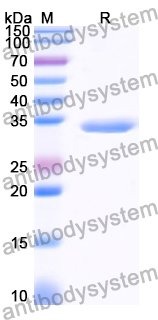 Recombinant Human PPY Protein, N-GST & C-His