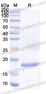 Recombinant Human IGF2 Protein, N-His