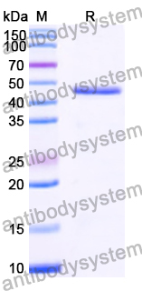 Recombinant Human PIIICP/COL3A1 Protein, N-His-SUMO