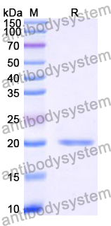 Recombinant Human TNNC2 Protein, N-His