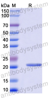 Recombinant Human APOC2 Protein, C-His