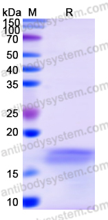 Recombinant Human PMP2 Protein, N-His