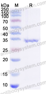 Recombinant Human FN1 Protein, N-His