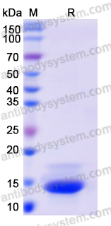 Recombinant Human EDB/EDB-FN Protein, N-His