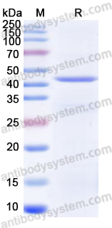 Recombinant Human AFP Protein, N-His