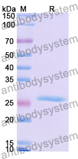 Recombinant Human MT-ND2 Protein, N-His-KSI