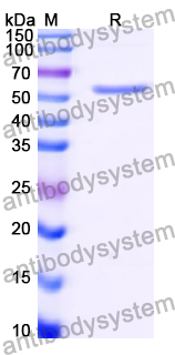 Recombinant Human GBA Protein, N-His