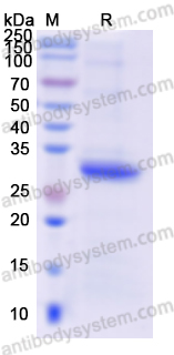 Recombinant Human ALDOA Protein, N-His
