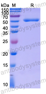 Recombinant Human ASL Protein, N-His