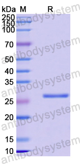 Recombinant Human WNT1 Protein, N-His