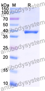 Recombinant Human ARG1/Arginase-1 Protein, C-His