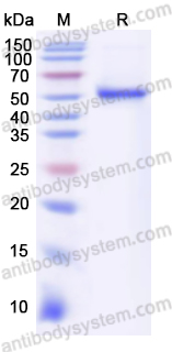 Recombinant Human ALDH2 Protein, N-His