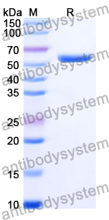 Recombinant Human ALDH2 (E504K) Protein, N-His