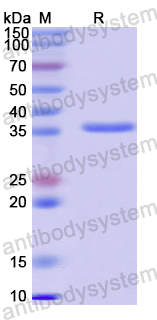 Recombinant Human PRKCG Protein, N-His