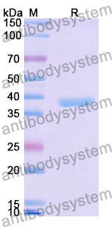 Recombinant Human F13B Protein, N-His