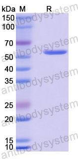 Recombinant Human CYP2E1 Protein, N-His
