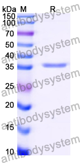 Recombinant Human RPLP0 Protein, N-His
