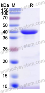 Recombinant Human JUN Protein, N-His
