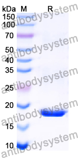 Recombinant Human REG1A Protein, N-His