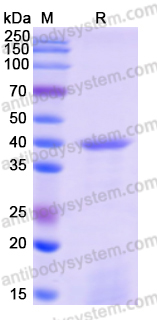 Recombinant Human PRKCB Protein, N-His