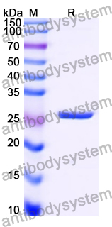 Recombinant Human CD5 Protein, N-His