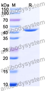Recombinant Human UROD Protein, N-His