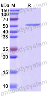 Recombinant Human ATP5F1B Protein, N-His