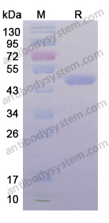 Recombinant Human CKM Protein, N-His