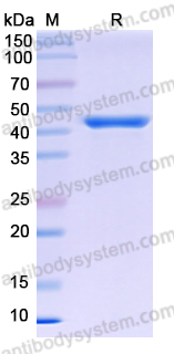 Recombinant Human CK-MB Protein, N-His & C-Strep