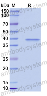 Recombinant Human POLB Protein, N-His