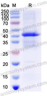 Recombinant Human SERPINE2 Protein, N-His