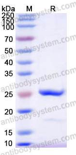 Recombinant Human CENPB Protein, N-His