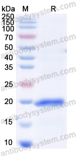 Recombinant Human GPX1 Protein, N-His