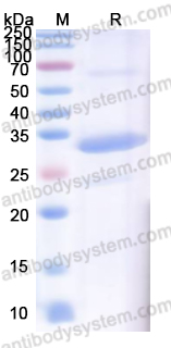 Recombinant Human PSA/KLK3 Protein, N-His