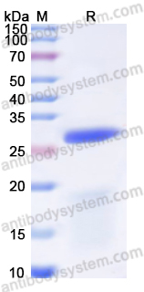 Recombinant Human BPGM Protein, N-His