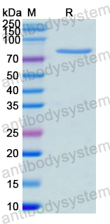 Recombinant Human HSP90AA1 Protein, N-His