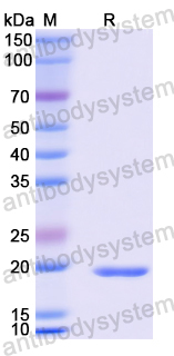 Recombinant Human HSP90AA1 Protein, N-His