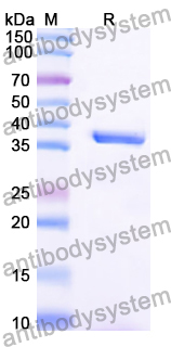 Recombinant Human GALT Protein, N-His