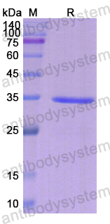 Recombinant Human ERCC1 Protein, N-His
