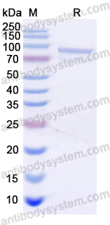 Recombinant Human HSP90AB1 Protein, N-His