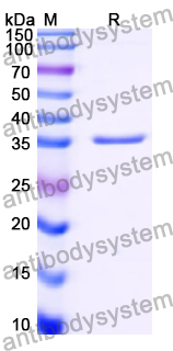 Recombinant Human SRPRA Protein, N-His