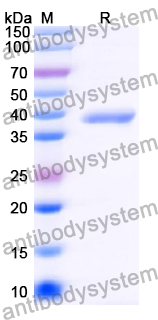 Recombinant Human SYP/Synaptophysin Protein, N-GST & C-His