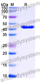 SDS-PAGE for Recombinant Human ADH4 Protein, N-His ?>