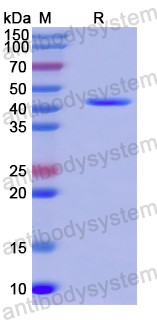 Recombinant Human MYL3 Protein, N-GST & C-His