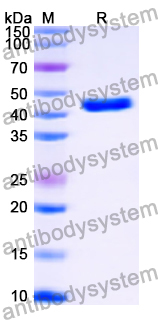 Recombinant Human CFH Protein, N-His