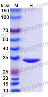 Recombinant Human ANXA5 Protein, Tag free