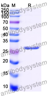 Recombinant Human IGFBP1 Protein, C-His