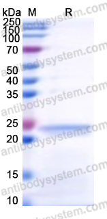 Recombinant Human RPSA Protein, N-His