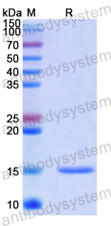 Recombinant Human SRP19 Protein, N-His